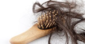Rimedi naturali per la caduta dei capelli, 4 trucchi che non conosci