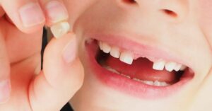 Conservare i denti da latte di tuo figlio potrebbe salvargli la vita: ti spieghiamo perché