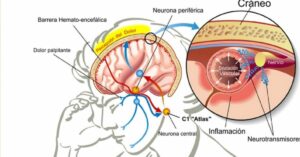 L’aggiunta di questa vitamina alla tua dieta riduce del 50% il rischio di emicranie frequenti