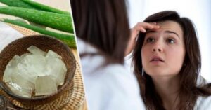 Come usare l’aloe vera contro le rughe