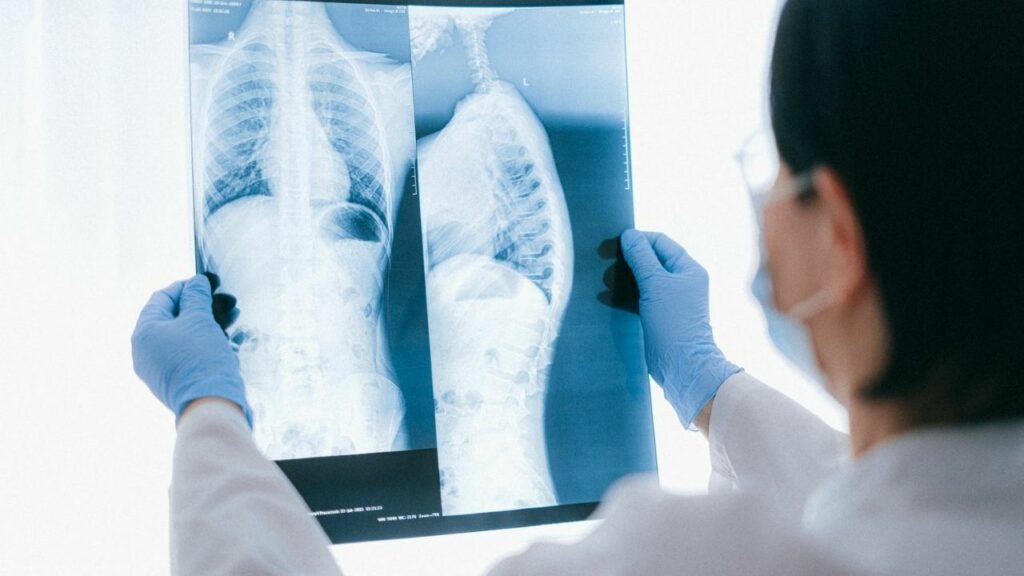 dottoressa controlla la radiografia dei polmoni