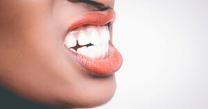 Rimedio naturale per sbiancare i denti senza rovinare lo smalto