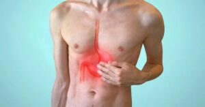 I sintomi del tumore allo stomaco: come riconoscerli in tempo