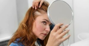 10 rimedi naturali per l’alopecia areata