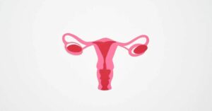 I segnali di pericolo sulle cisti ovariche che le donne ignorano