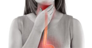 Come risolvere il prurito alla gola con 4 rimedi naturali