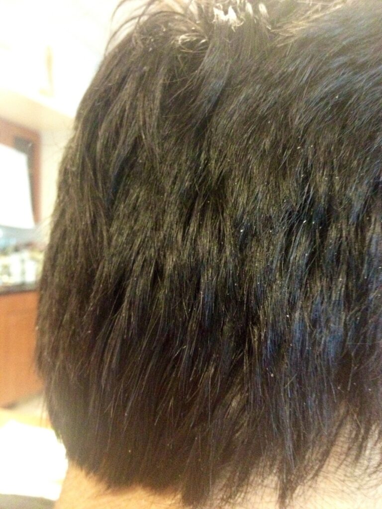 Forfora capelli