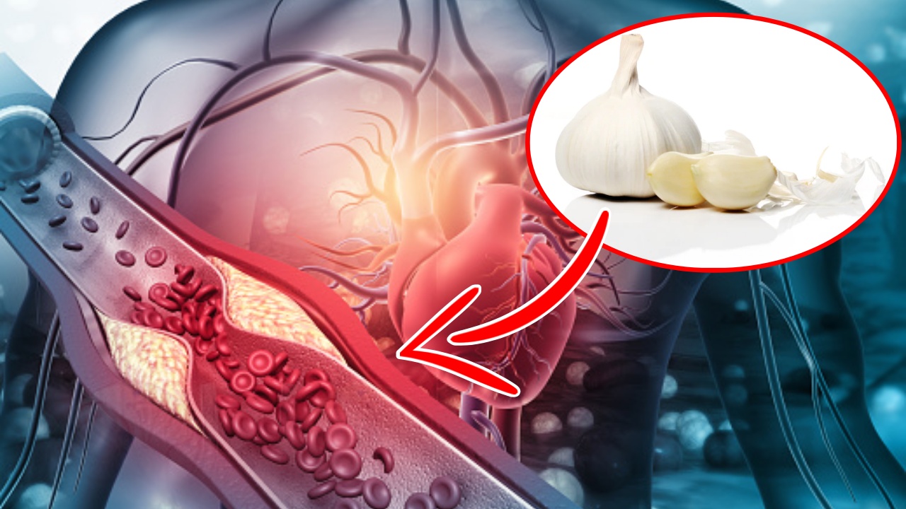Usare l'aglio per la pressione alta