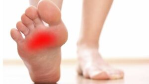 Il dolore alla pianta del piede accomuna tante persone: cause, sintomi e trattamento