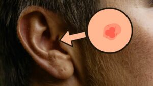 problemi all'orecchio