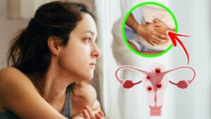 Cause e sintomi del mioma uterino