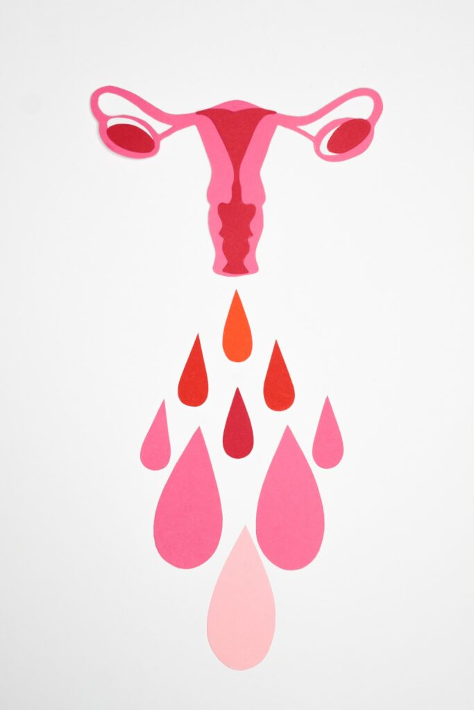 Sanguinolento vagina