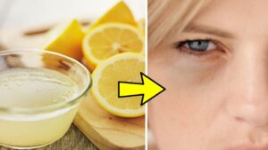 succo di limone e limone contro le occhiaie