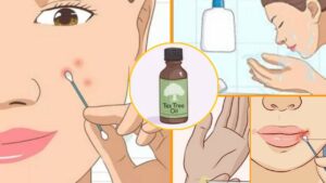 Tea Tree oil: come usarlo e perché