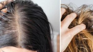 I capelli si sporcano frequentemente? Alcuni semplici TRUCCHI da provare