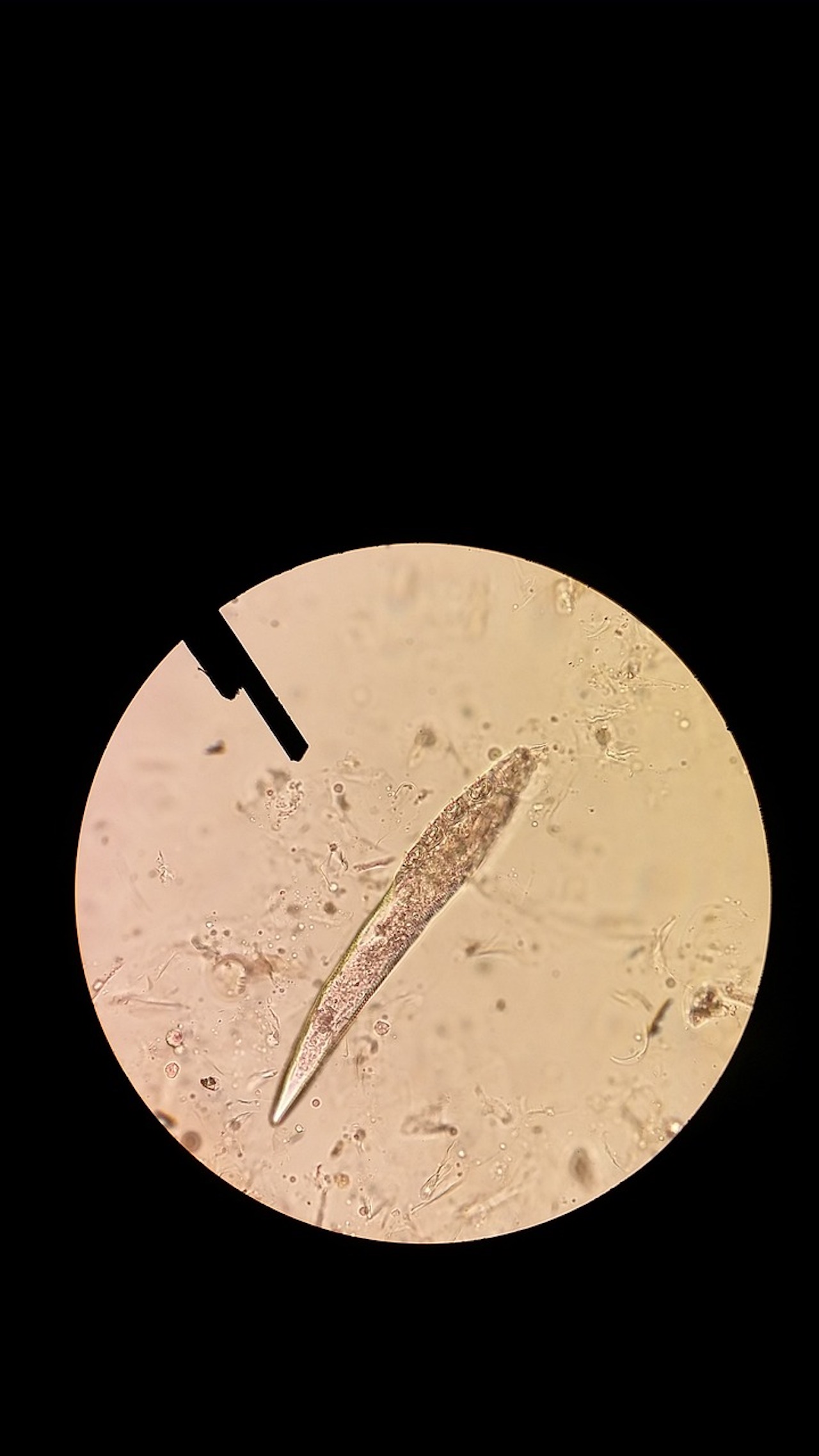 Demodex