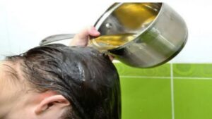 Un rimedio naturale ed efficace per la caduta dei capelli: ecco cosa devi fare