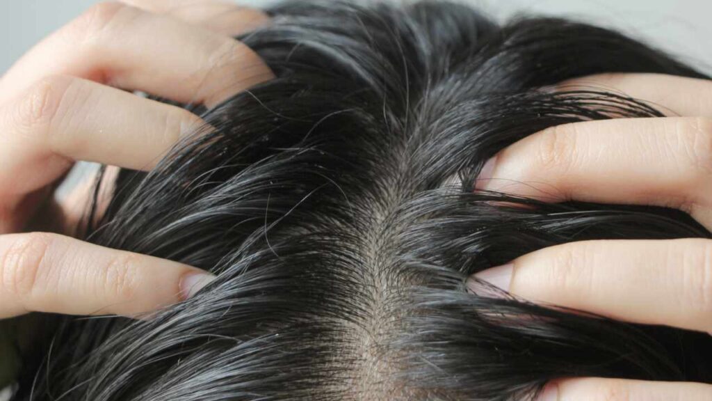 Le cause dei capelli grassi e cosa fare per tenerli puliti più a lungo