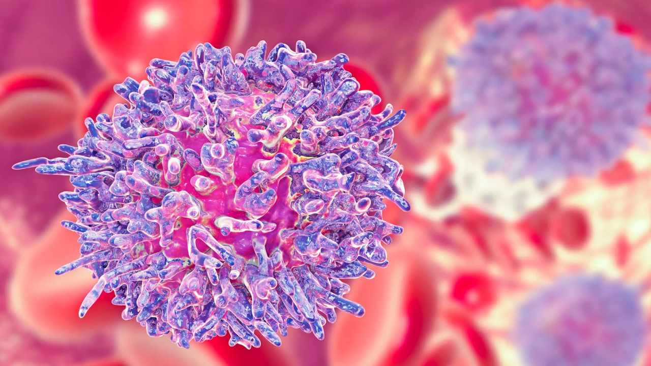 sintomi leucemia