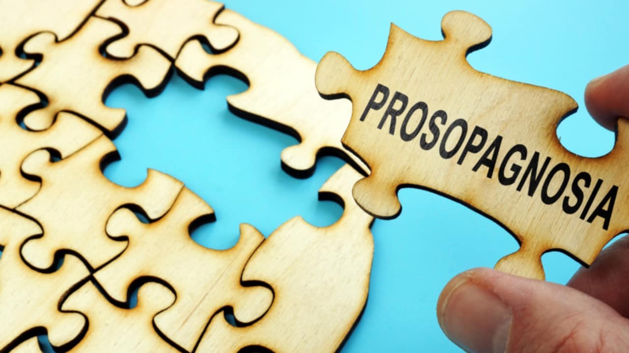 prosopagnosia
