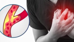 I 9 migliori alimenti per purificare arterie e vene
